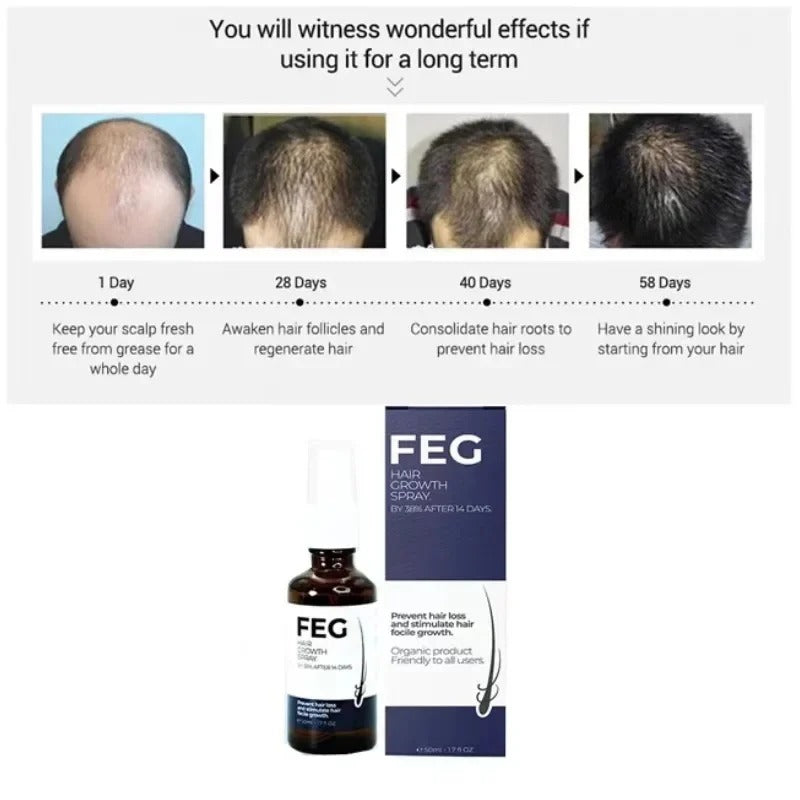 FEG Plus Hair Growth Spray – Stimulates Follicles & Reduces Hair Fall