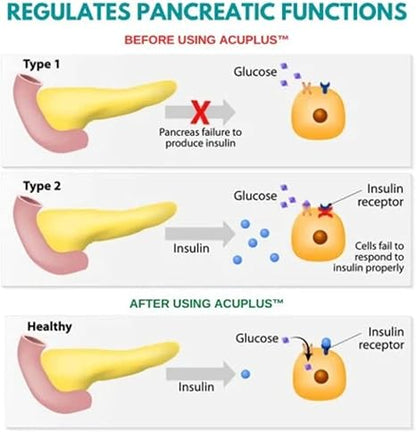 Sugar Acupressure LI-4 Magnetic Clip