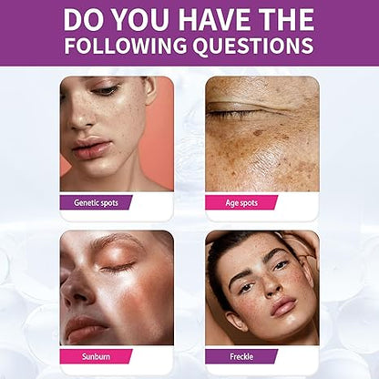 Spot Fading Urea ,Dark Spot Reducing,𝐖𝐡𝐢𝐭𝐞𝐧𝐢𝐧𝐠 and 𝐅𝐫𝐞𝐜𝐤𝐥𝐞 Removal Cream