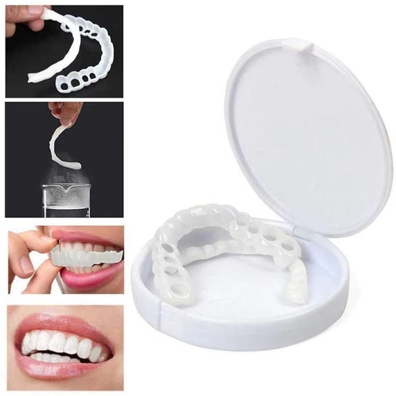 Snap on Smile Teeth Whitening veneers (Perfect Smile)