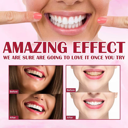 Whitening Toothpaste Sp4 Ultra Whitening Teeth Plaque Remover