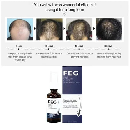 FEG Plus Hair Growth Spray – Stimulates Follicles & Reduces Hair Fall