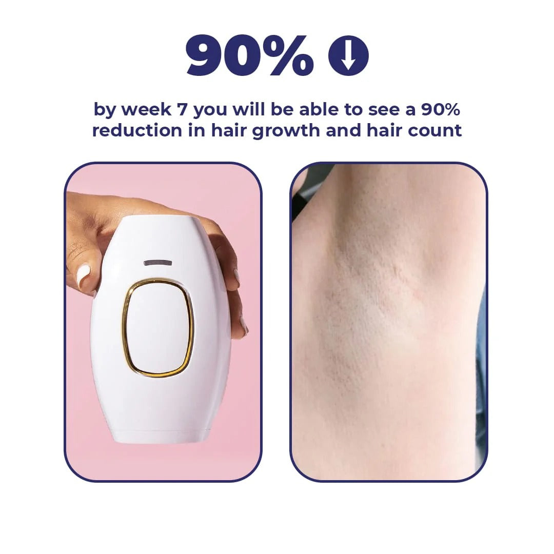 IPL Portable Laser Hair Removal