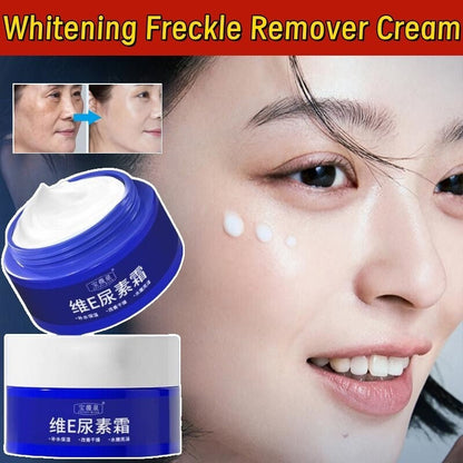Spot Fading Urea ,Dark Spot Reducing,𝐖𝐡𝐢𝐭𝐞𝐧𝐢𝐧𝐠 and 𝐅𝐫𝐞𝐜𝐤𝐥𝐞 Removal Cream