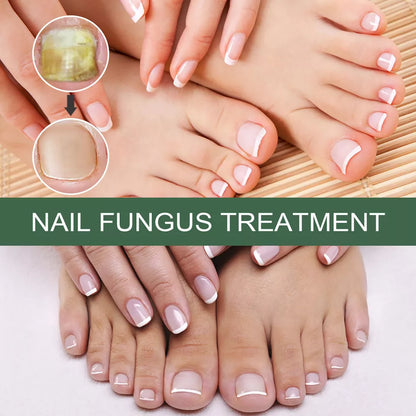Fast Nail Fungal Treatments Nail Repair Essences Serum